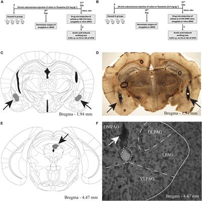 Chronic Fluoxetine Impairs the Effects of 5-HT1A and 5-HT2C Receptors Activation in the PAG and Amygdala on Antinociception Induced by Aversive Situation in Mice